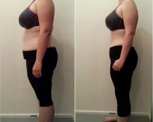 mulher_dep_compressor